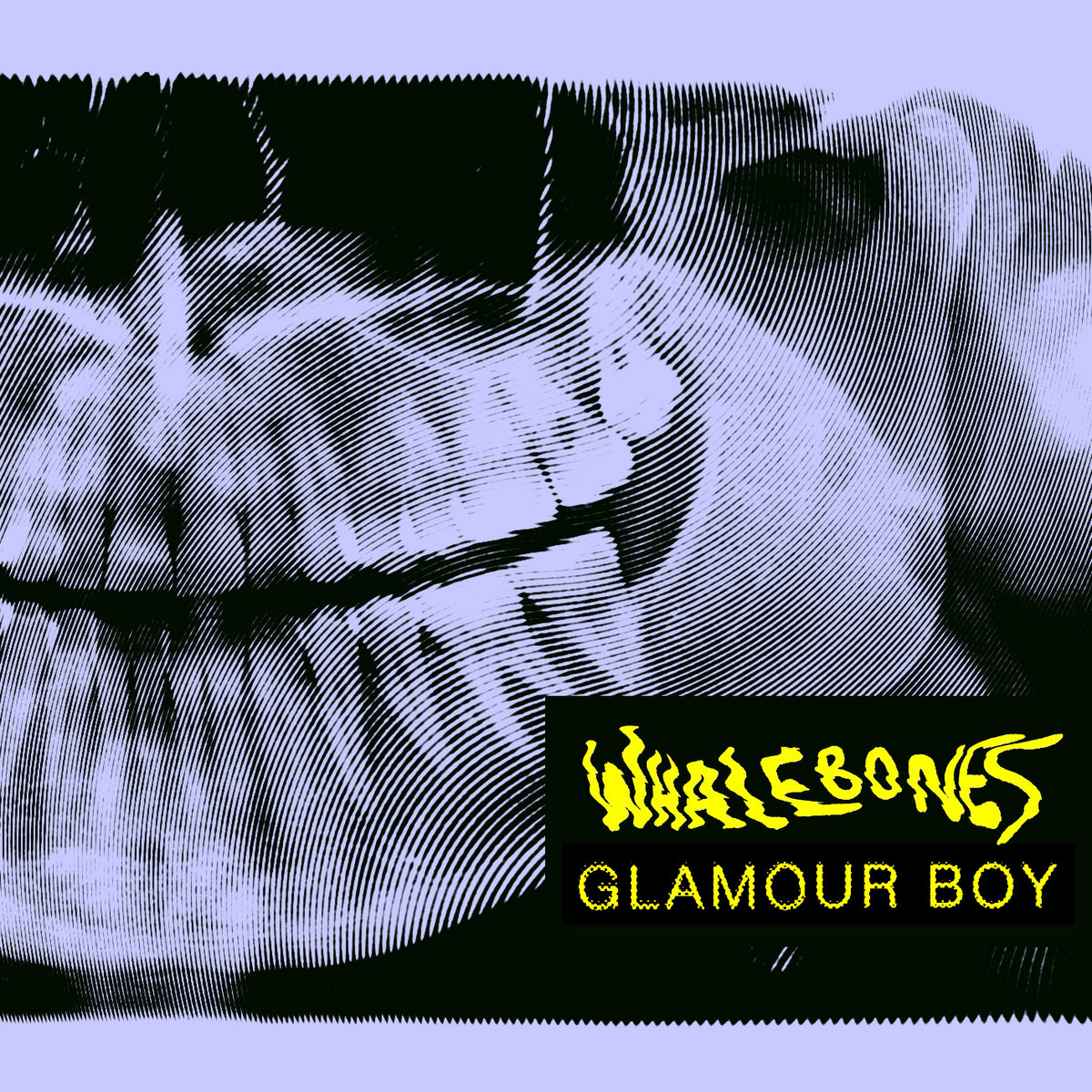 the album artwork of GLAMOUR BOY by Whalebones
